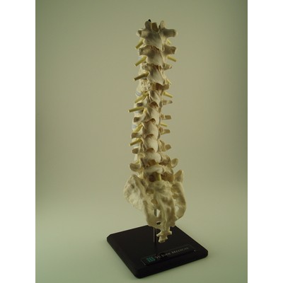 Tall Spine Model